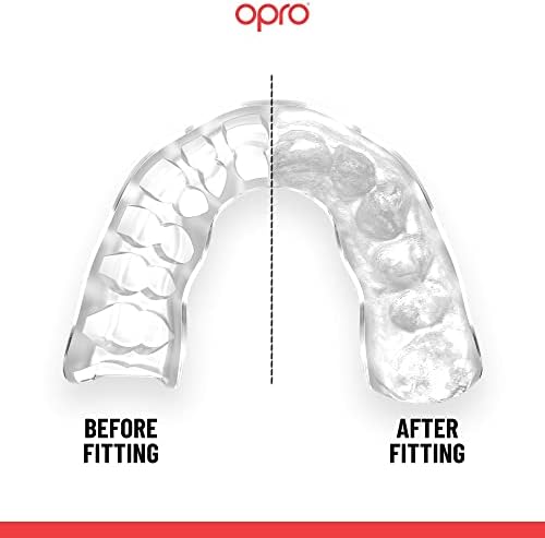 Устата охрана OPRO Instant индивидуална монтаж, устата охрана за стоматолози с Революционна технология на монтаж