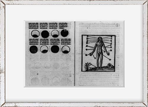 БЕЗКРАЙНИ СНИМКИ 1516 Снимка: Ръководство за кровопусканию | Фаза на Луната, Точка, приложен към гола фигура | Книга на кровопусканию | Ретро декор за снимки